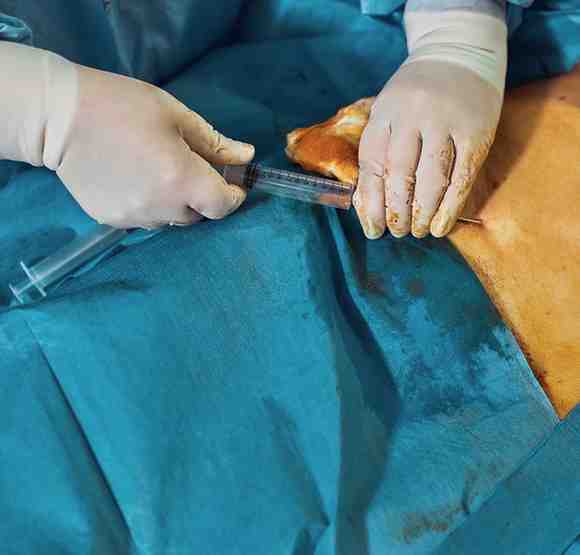 Fat Injection Penis prosedur biaya siapa yang cocok