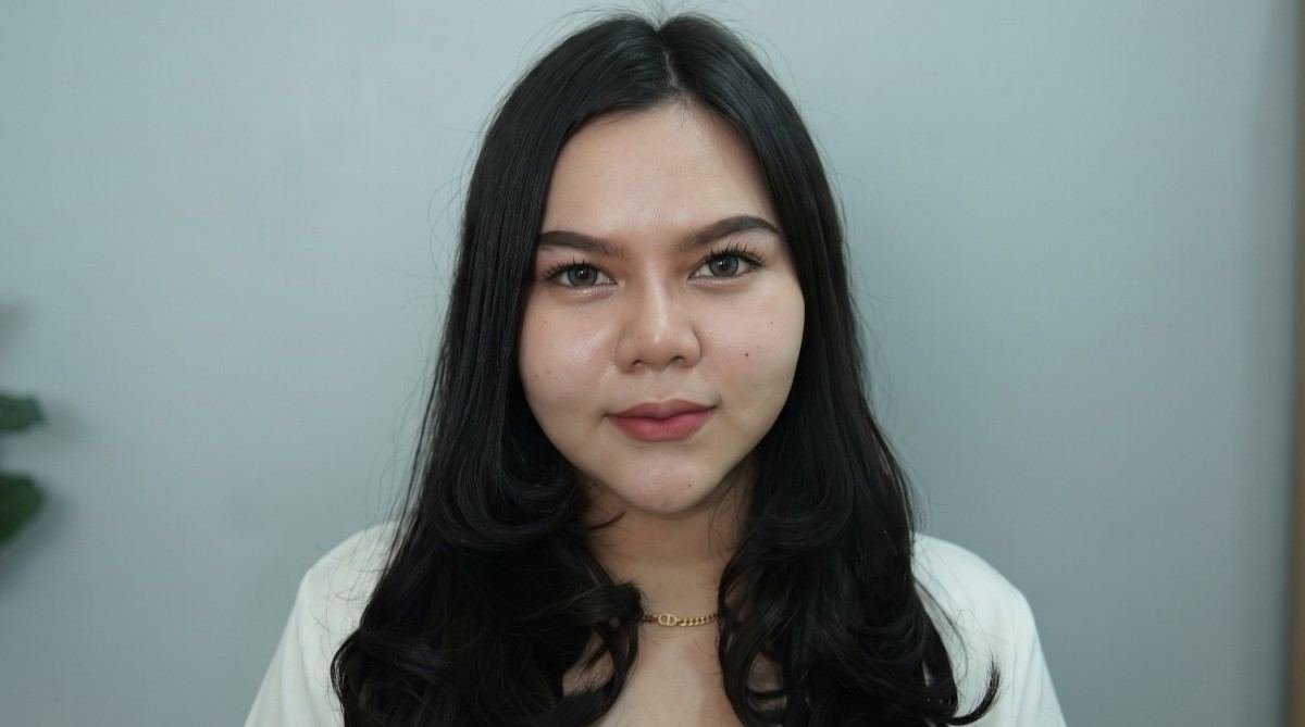 Konsultasi Rhinoplasty Setelah Filler Hidung di Jakarta Barat