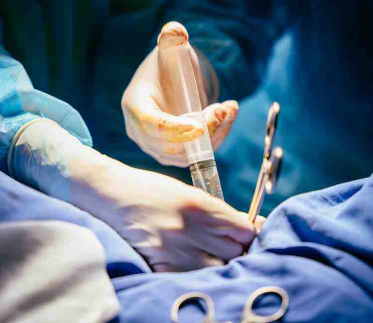 Filler Penis Cara Kerja Manfaat untuk Pria