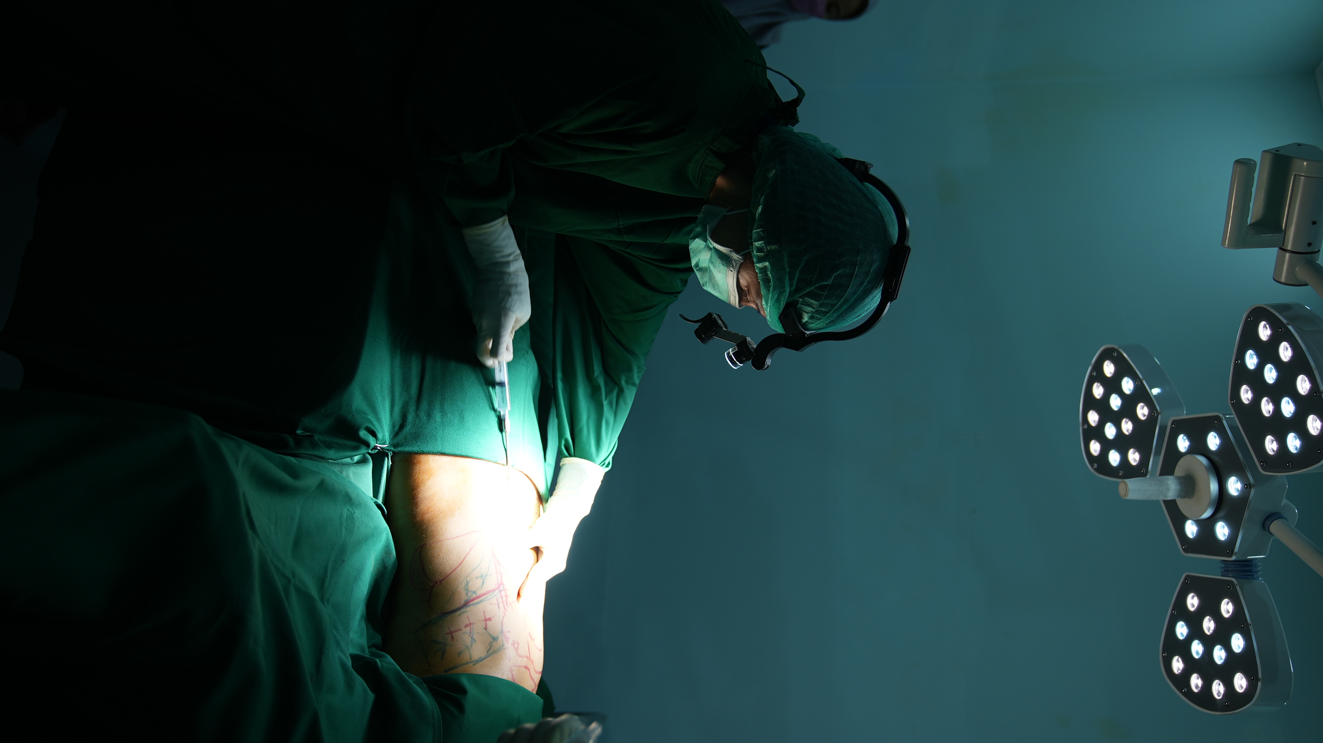 Sedot Lemak Turun Berapa Kg?