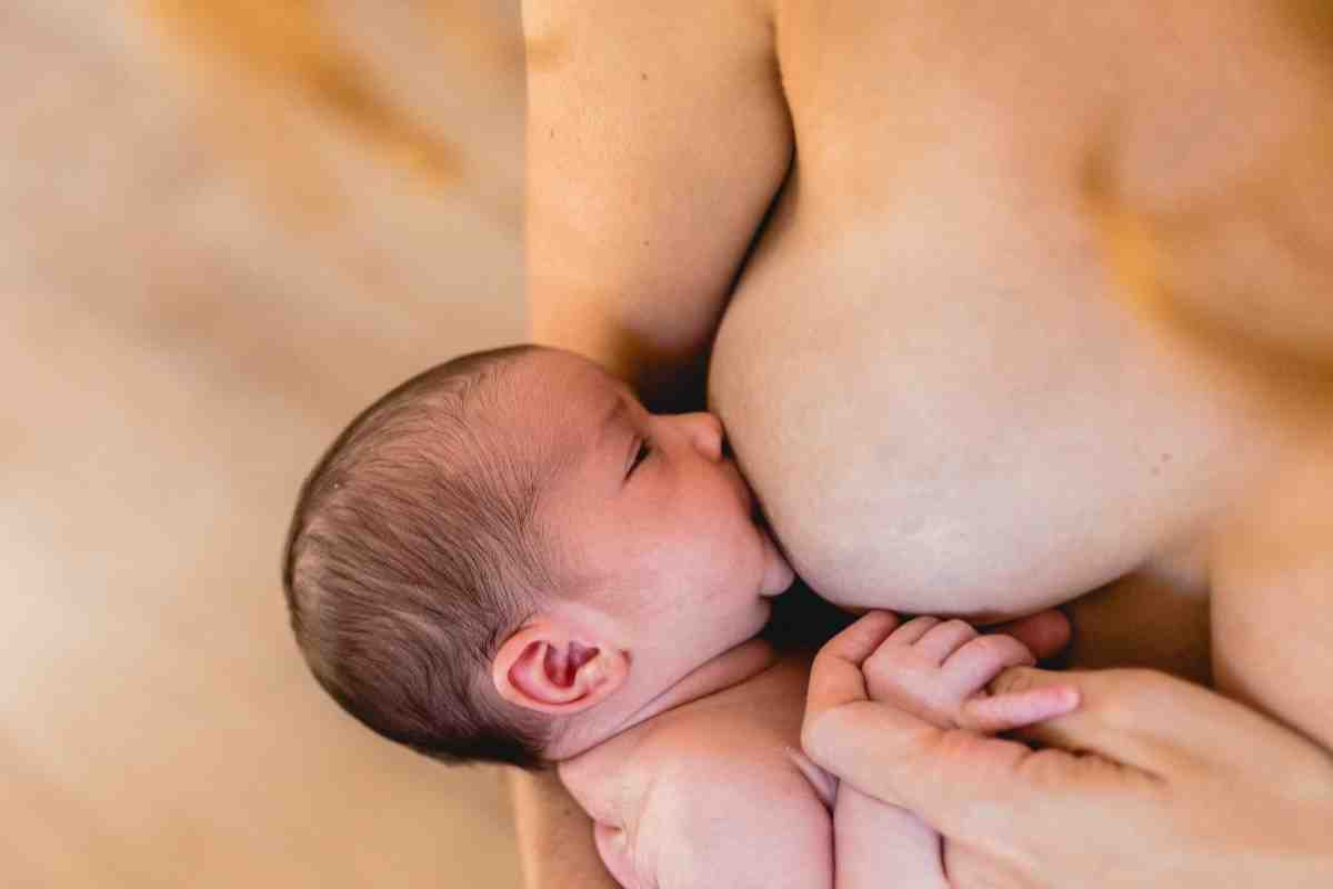 Nipple Reduction atau Breast Lift untuk Perubahan Payudara Setelah Menyusui Jakarta
