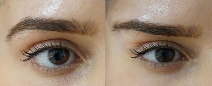 Fox Eye Lift Berapa Derajat Terbaik