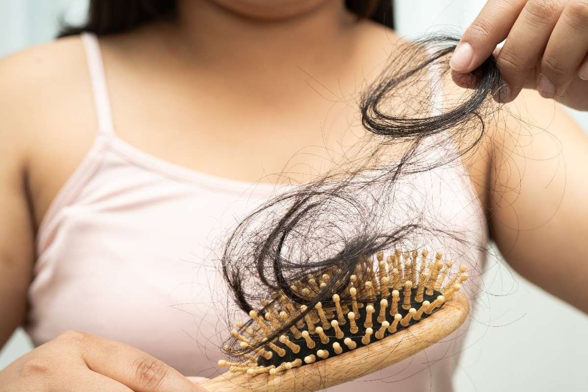 Treatment Rambut Rontok di Bekasi