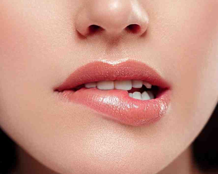 Panduan Klinis Lip Filler: Prosedur Medis, Durasi Ketahanan, dan Rincian Biaya