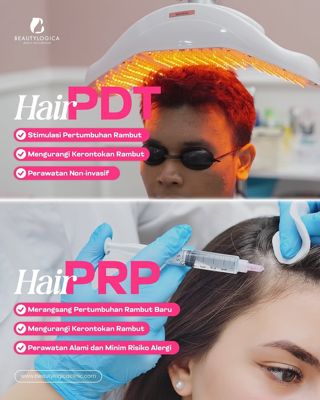 Treatment Rambut Rontok Wanita di Jakarta