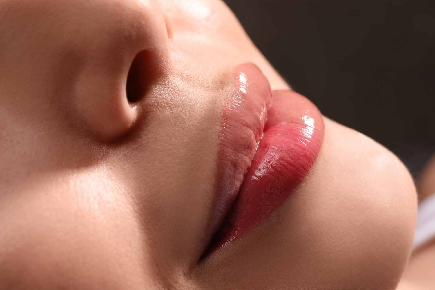 Lip Filler di Balikpapan