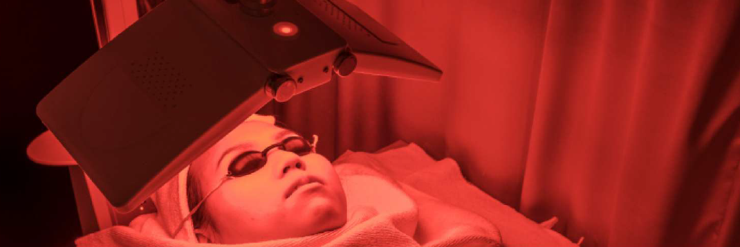 Treatment FACE PDT Terbaik Bintaro