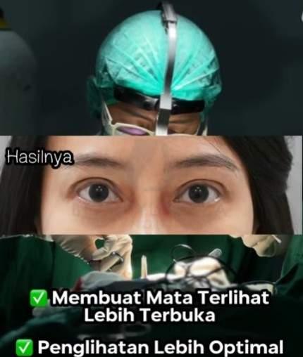 Dokter Bedah Plastik Kelopak Mata Bandung Terbaik