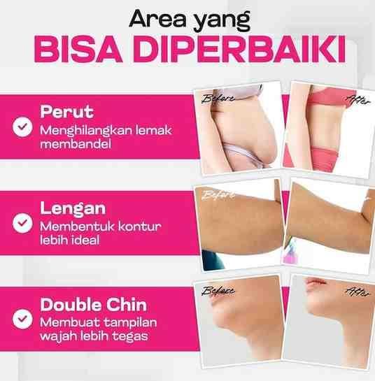 harga sedot lemak di bandung 