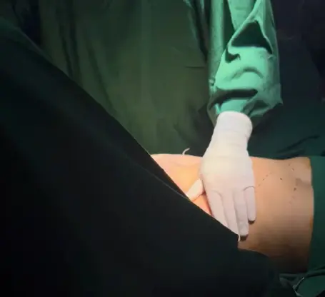 Klinik Sedot Lemak Terbaik Senayan