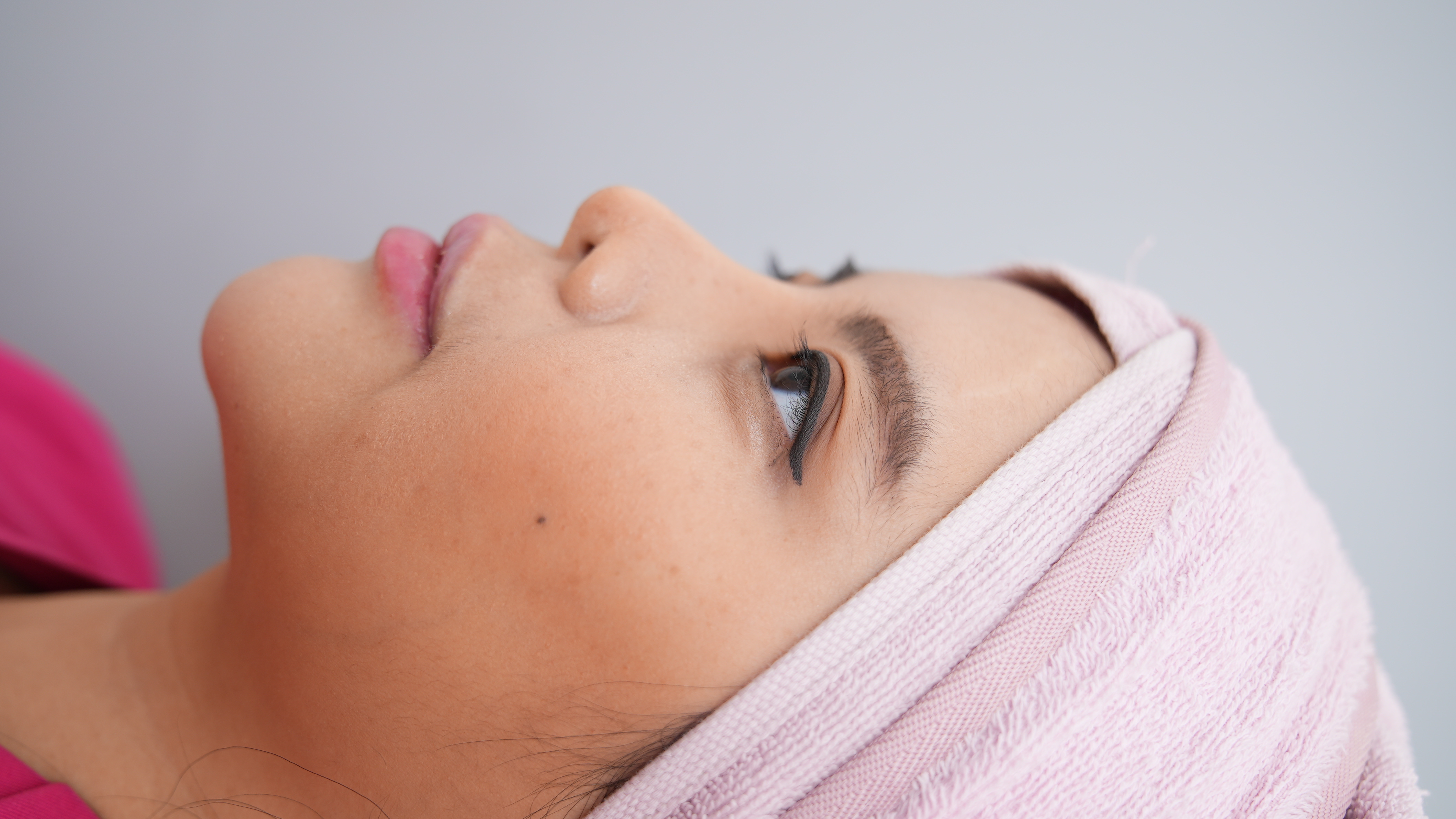 Buccal Fat Removal Wanita Tembem